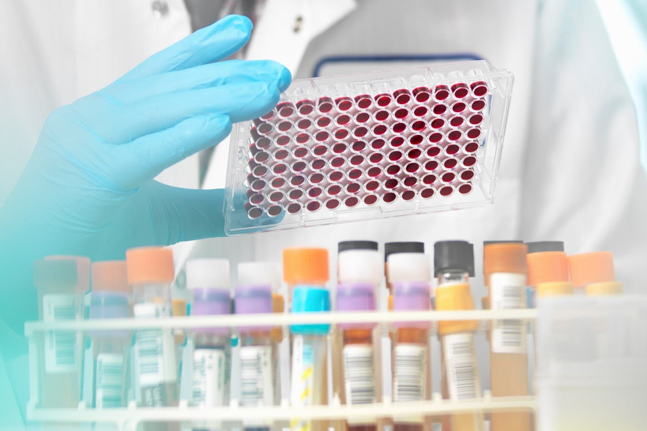 blood test